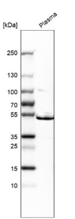 ST3 beta-Gal alpha-2,3-Sialyltransferase 1/ST3GAL1/SIAT4A Antibody, Novus